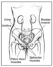 Anatomical drawing front view of the female urinary tract. Labels point to pelvic floor muscles, sphincter muscles, bladder muscle, urethra, and urine.