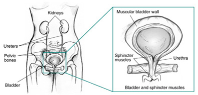 Front view diagram of female urinary tract with labels pointing to kidneys, ureters, pelvic bones, and bladder.  An inset shows an enlarged view of the bladder and sphincter muscles with labels pointing to the muscular bladder wall, sphincter muscles, and urethra.