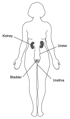 Diagram of the urinary tract shown within the outline of a female figure.  Labels point to the kidney, ureter, bladder, and urethra.